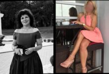 Intervenții | MyTex.ro