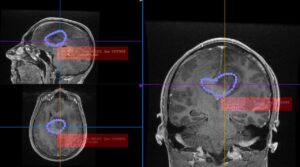 Salvamont | MyTex.ro