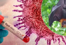 Alimentație | MyTex.ro