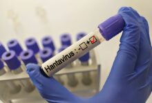 Suspiciune de hantavirus