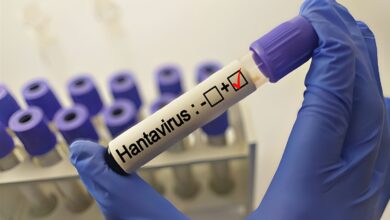 Suspiciune de hantavirus