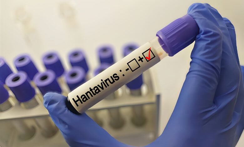 Suspiciune de hantavirus