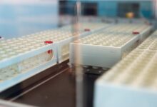 Noutate la Spitalul Județean Brașov: Pacienții pot verifica online fondurile disponibile pentru analize și investigații gratuite 5 braşov | MyTex.ro