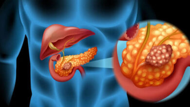 Pancreas | MyTex.ro