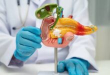 Spital | MyTex.ro