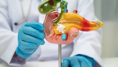 Pancreatita | MyTex.ro