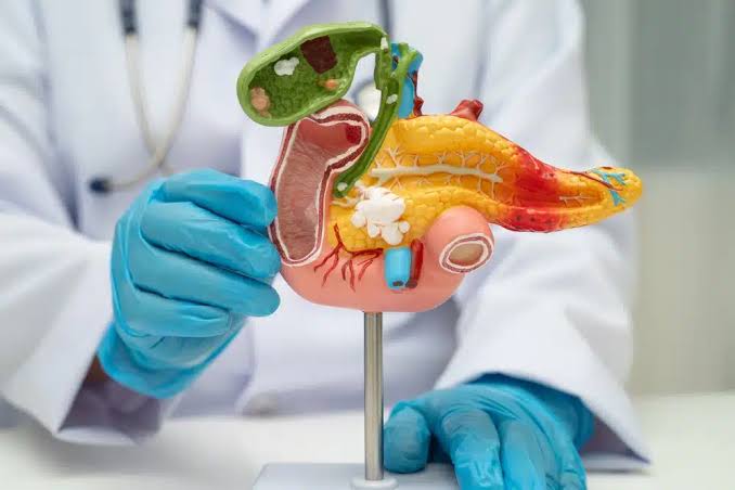 Pancreatita, boala care poate apărea fără avertisment. Dr. Mihail Pautov explică simptomele care impun prezentarea de urgență la spital 3 Pancreatita | MyTex.ro