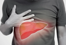 ALERTĂ SANITARĂ ÎN BRAȘOV: Focare de hepatită A în mai multe localități! Zeci de copii au ajuns deja la medic 3 | MyTex.ro